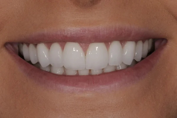 Simply Amazing Smiles