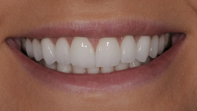 Simply Amazing Smiles